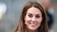 Ugledni stručnjak tvrdi da se Kate Middleton podvrgla botoksu, iz palače to demantiraju; što je istina?