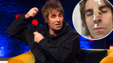 Liam Gallagher doživio nesreću: 'Sinoć sam ispao iz helikoptera, ne može sve ići glatko'