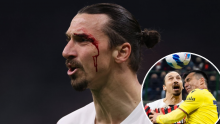 [FOTO] Težak sudar na San Siru; Zlatanu Ibrahimoviću razbijena arkada, a suparnik je prošao puno gore