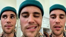 Justin Bieber otkrio da oporavlja od paralize lica, u video je pokazao o kakvom se stanju radi: 'Kao što vidite ne mogu trepnuti niti se nasmijati'