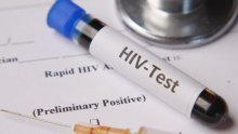 Lani više od 2000 ljudi u Hrvatskoj dobilo HIV/AIDS: Ovo su najčešće spolne bolesti