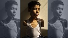 Najbolja novinska fotografija u svijetu prikazuje palestinskog dječaka koji je ostao bez obje ruke u ratu u Gazi