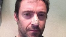 Hugh Jackman objavio da ima rak