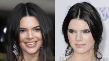 Žrtva ismijavanja: Kendall Jenner na crvenom tepihu osvanula s napumpanim usnama i oronulim tenom