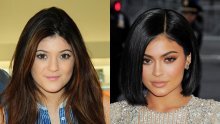 Kylie Jenner tvrdi kako se nikad nije podvrgla kozmetičkoj operaciji