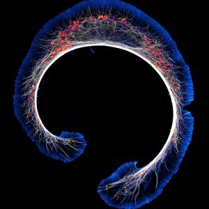 19. Rani stadij diferencijacije stanica mišjeg neuroblastoma (aktin, mikrotubule i mitohondriji)