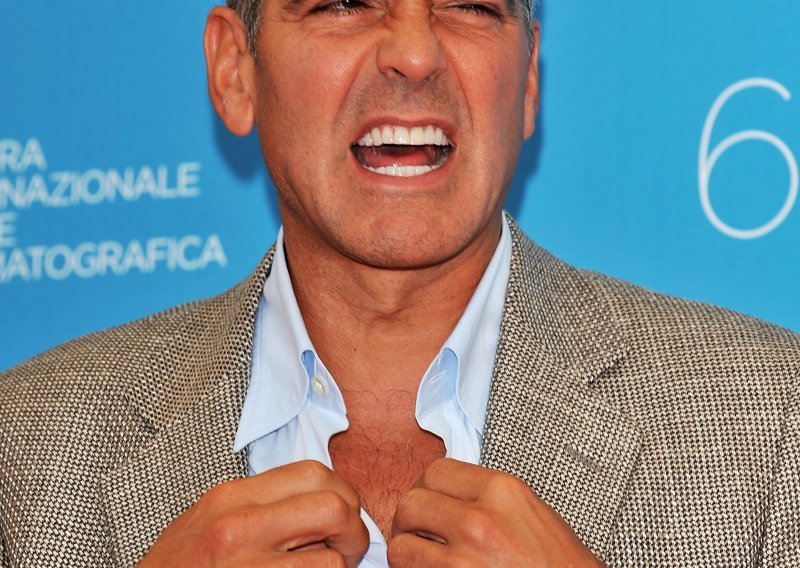 George Clooney sam sebi slomio ruku