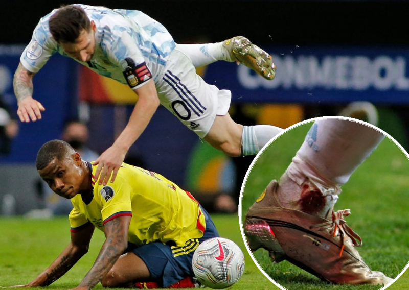[VIDEO] Leo Messi preživio je kolumbijsko 'masakriranje'; Argentina tek nakon lutrije penala izborila finale Copa Americe s Brazilom