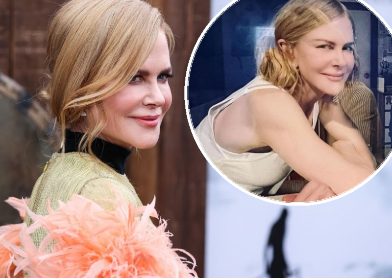 Što je to Nicole Kidman napravila s licem? Glumica objavila novu fotografiju na kojoj je gotovo neprepoznatljiva