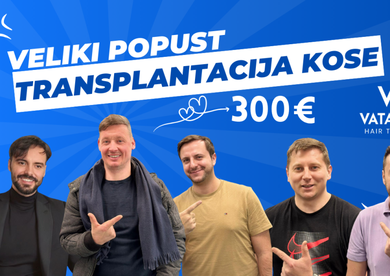 Transplantacija kose po super cijeni za Valentinovo!