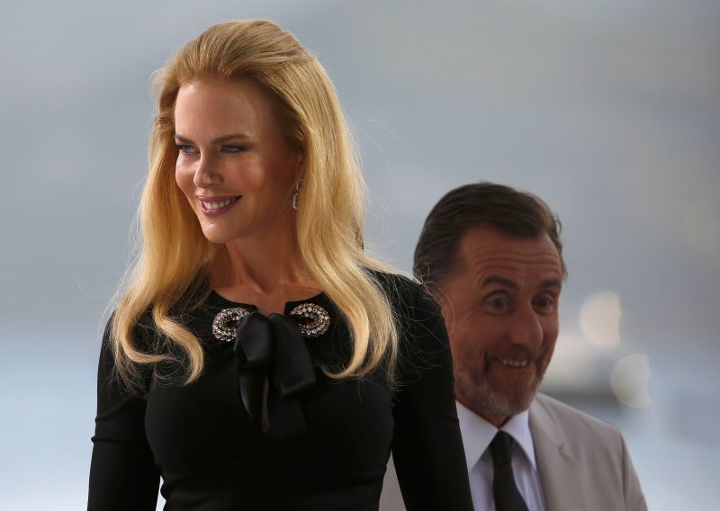 Što se dogodilo s licem Nicole Kidman?