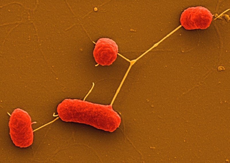 U Hrvatskoj nema opasnosti od epidemije superbakterije