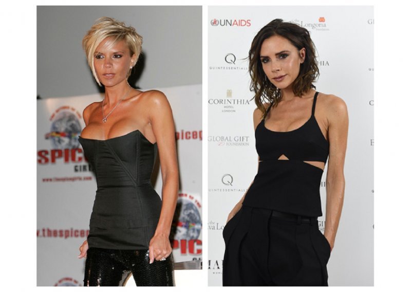 Victoria Beckham priznala zašto je povećala grudi