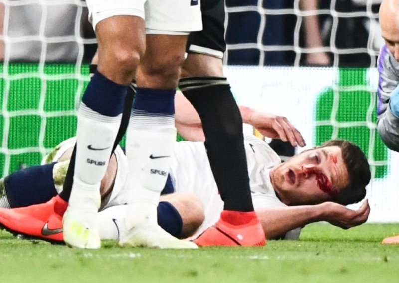 Užas u Londonu; strašan sudar nogometaša u kojem je najgore prošao Jan Vertonghen