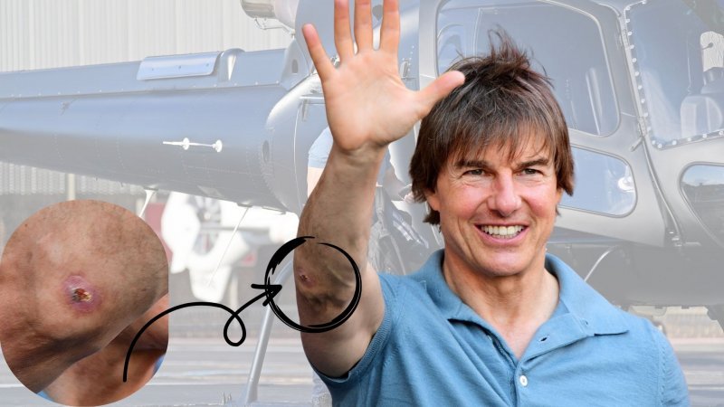 Tom Cruise