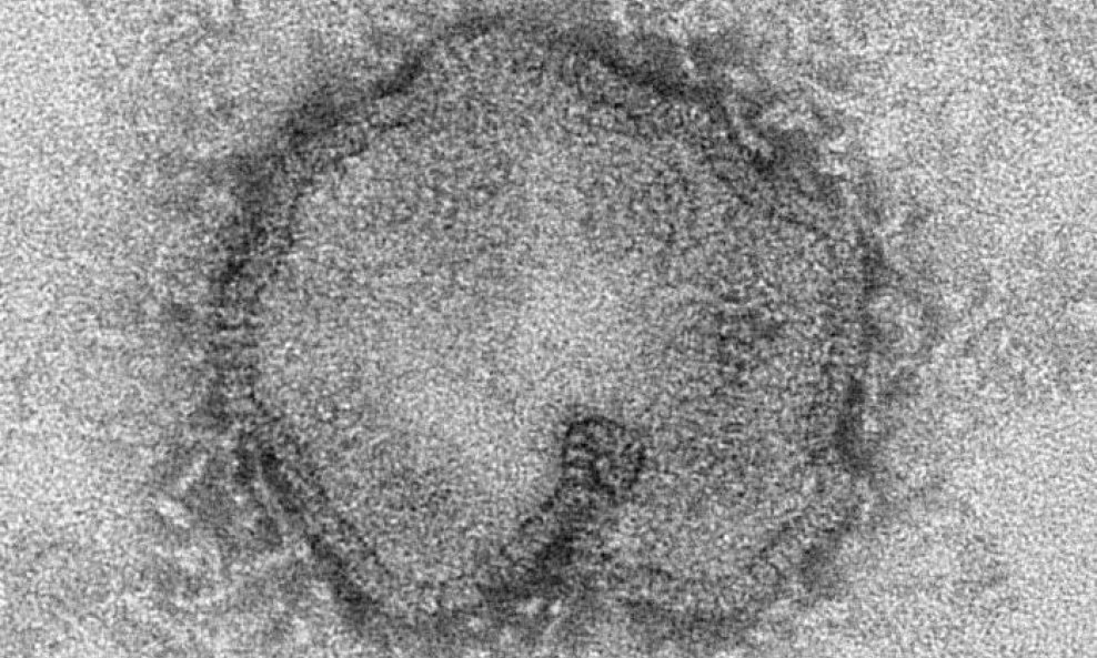 Virus H7N9