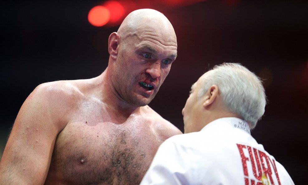 Tyson Fury