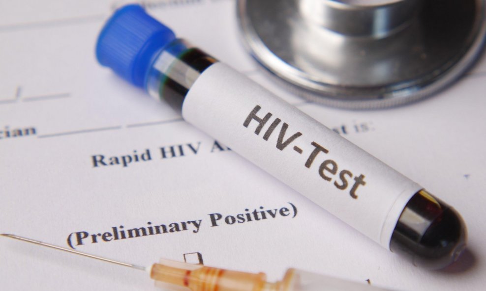 HIV test