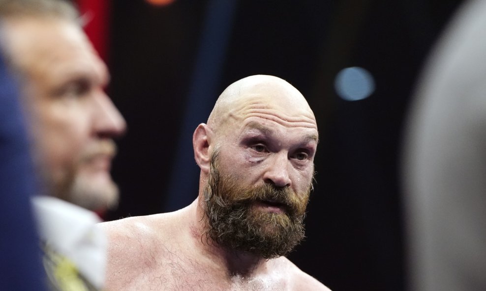 Tyson Fury