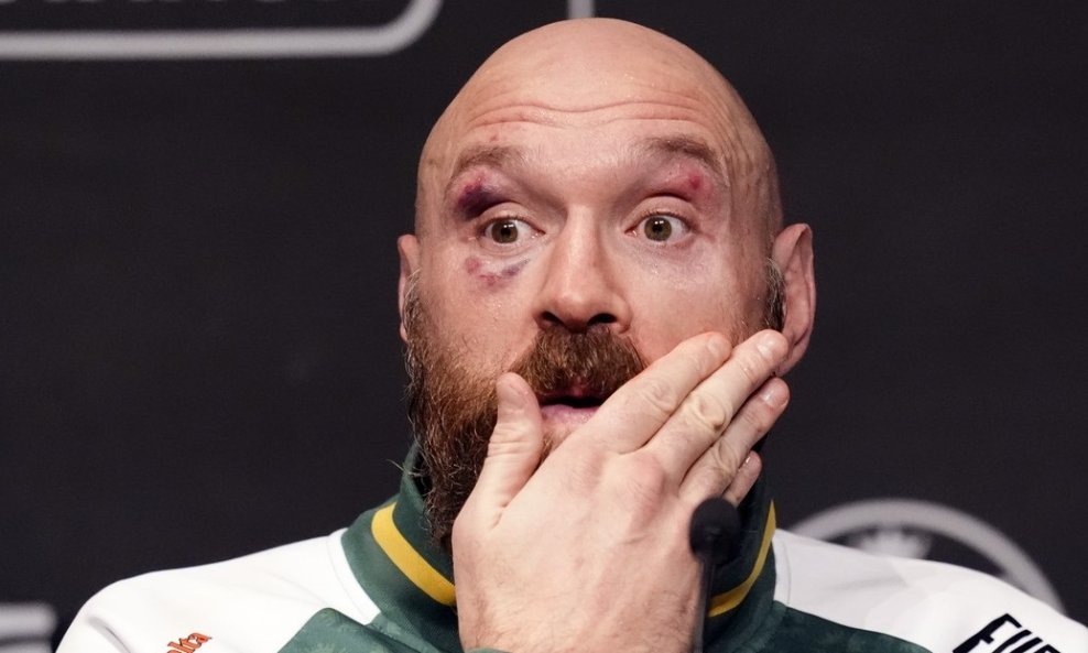 Tyson Fury