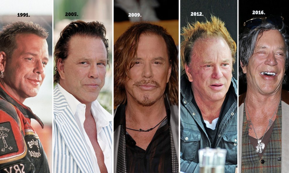 Mickey Rourke