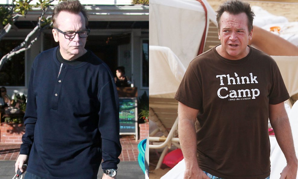 Tom Arnold