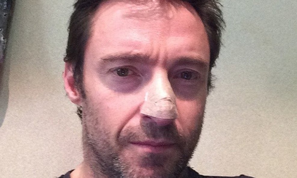 Hugh Jackman