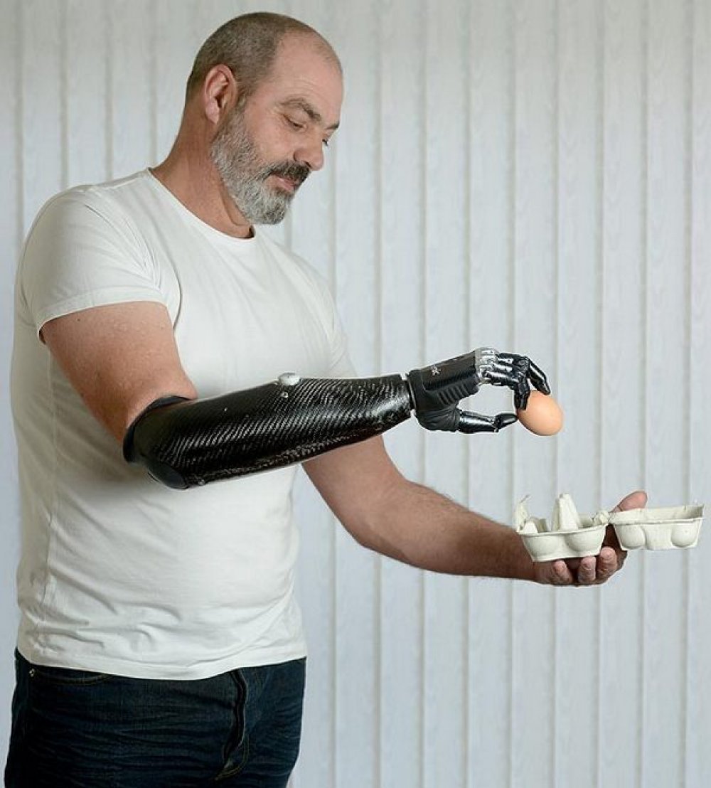 Самый дорогой протез. Металлический протез руки. Бионические протезы. Современные протезы рук. Механические протезы.